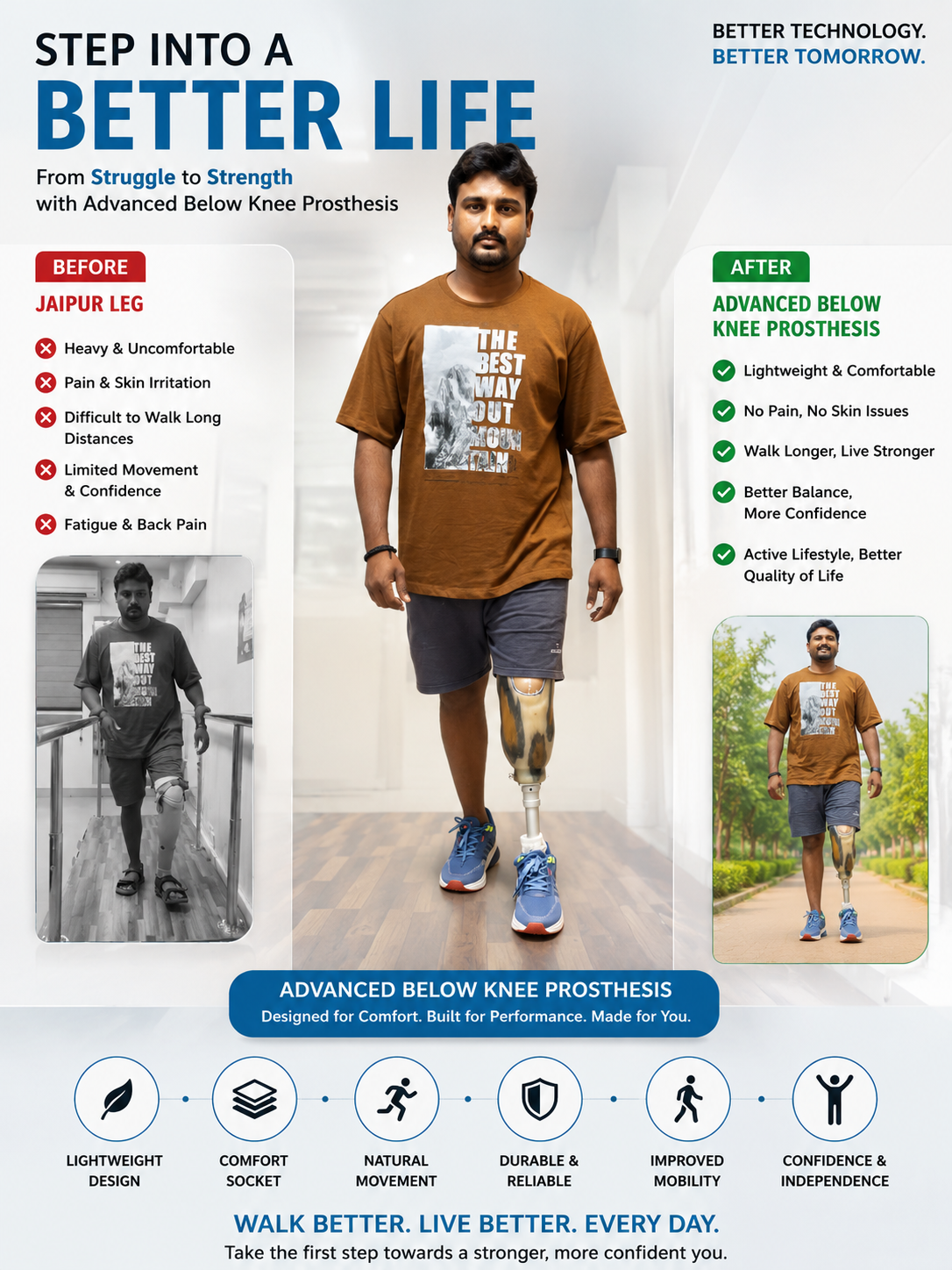 global grace below knee prosthesis poster